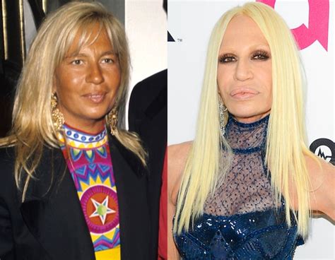 donatella versace avant|donatella versace face what happened.